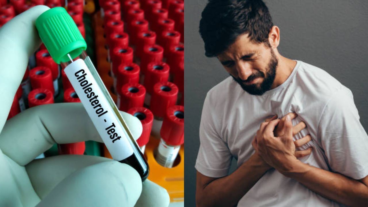 High Cholesterol কোলেস্টেরল নিয়ে এখনও সচেতন নন? অবহেলায় এই ৪ রোগ