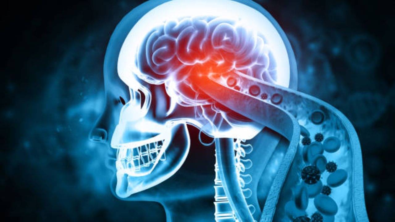 National Epilepsy Day: মৃগীরোগে আক্রান্ত, জীবনভর ওষুধই ভরসা? যা বলছেন বিশেষজ্ঞরা