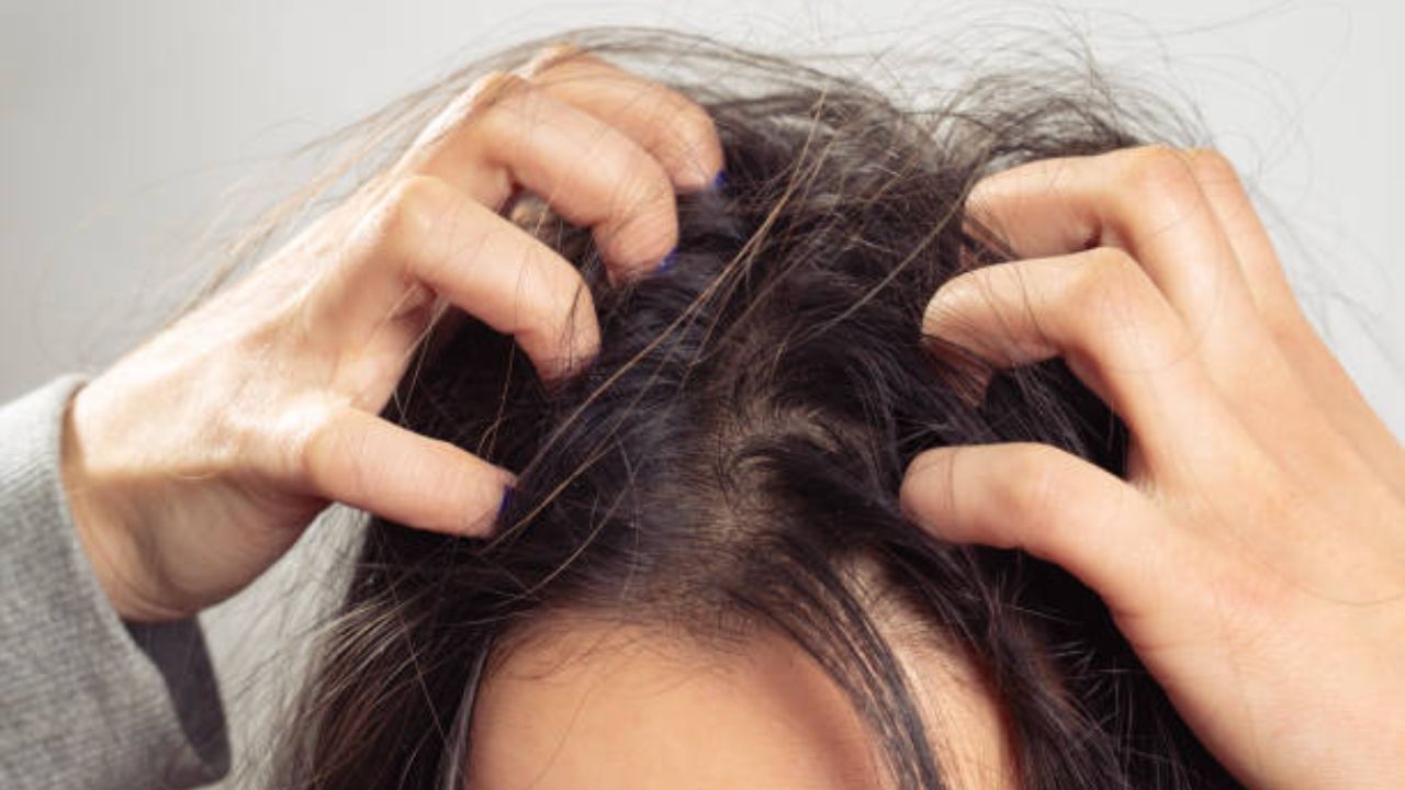 Winter Hair Care Tips: উষ্ণতা কমতেই স্ক্যাল্পে খুশকি দেখা দিয়েছে? চুলের শুষ্কভাব দূর করুন ঘর‍োয়া উপায়ে
