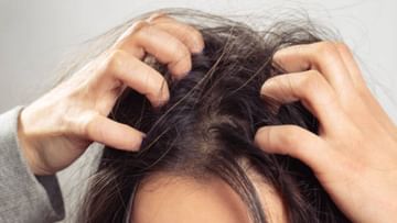 Winter Hair Care Tips: উষ্ণতা কমতেই স্ক্যাল্পে খুশকি দেখা দিয়েছে? চুলের শুষ্কভাব দূর করুন ঘর‍োয়া উপায়ে