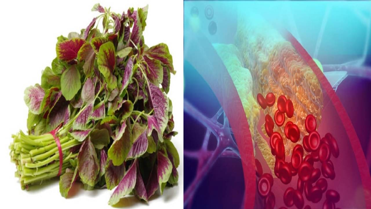 Note Saag: গ্রামবাংলার এই শাক যে কোনও সবজিকে দশ গোল দেয়, শীতের মরশুমে অল্প করে রোজ খান