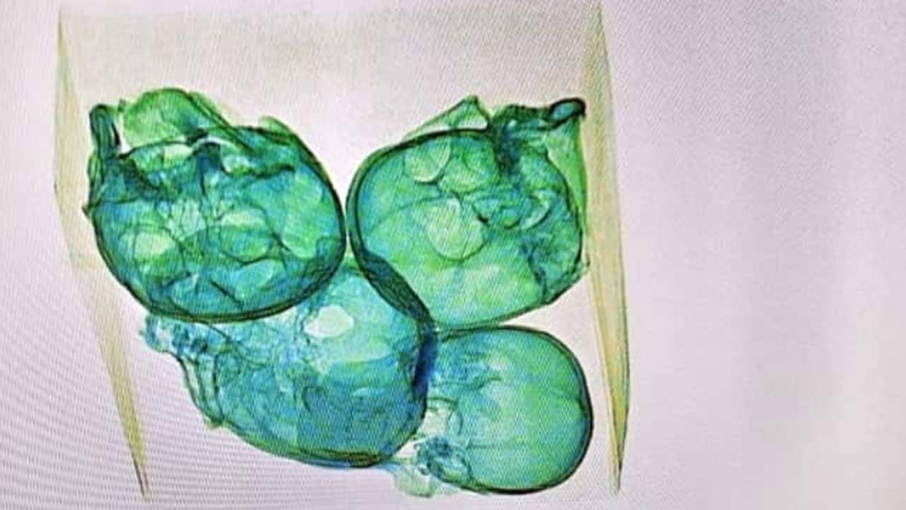 Human Skull: বিমানবন্দরে প্যাকেজের মধ্যে চারটি মানুষের খুলি! হতবাক আধিকারিকরা