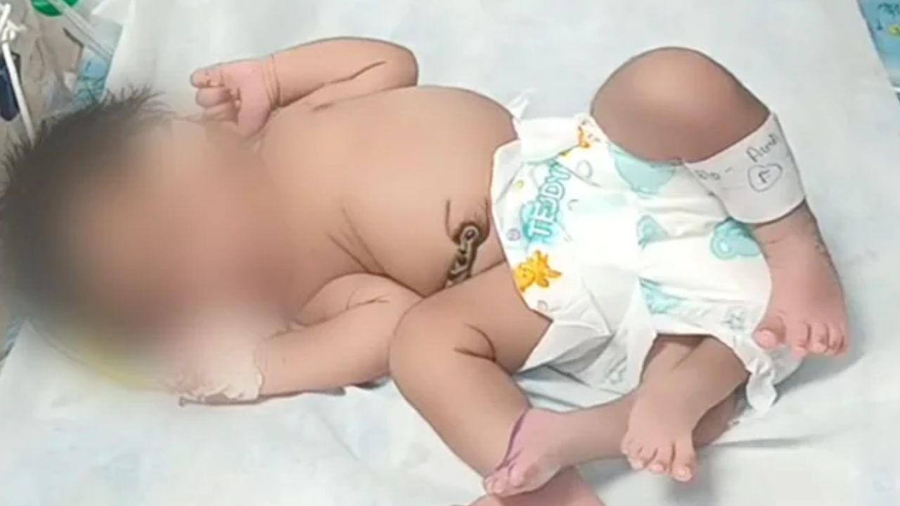Madhya Pradesh Baby: নবজাতকের চার পা, শারীরিক বিকৃতি থাকলেও সুস্থ-ই রয়েছে শিশুকন্যা
