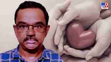 Organ Donation: নাট্যকর্মীর ব্রেনডেথ! রাজ্যে এই প্রথম একই শরীরের সাত অঙ্গে নতুন জীবন পেতে চলেছে সাতটি প্রাণ