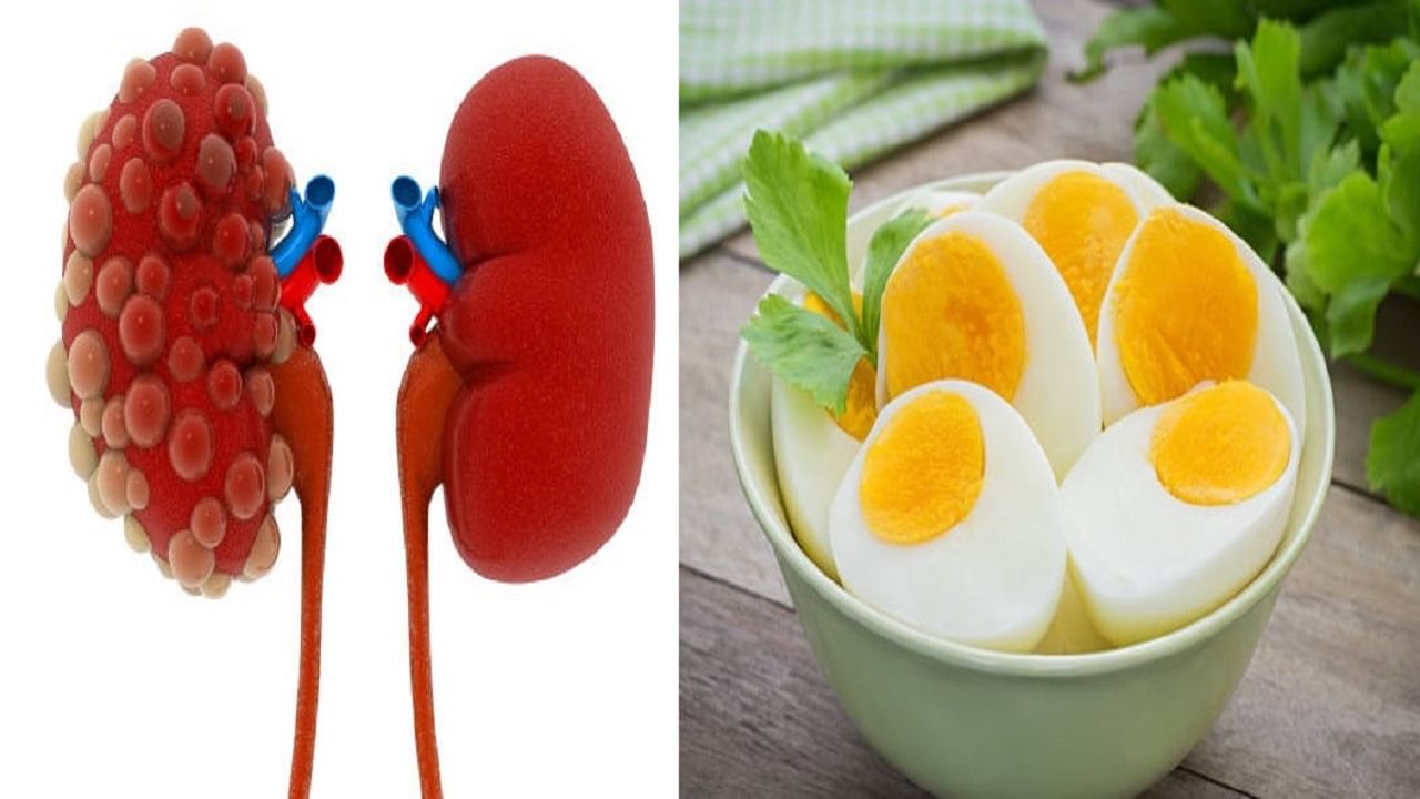 kidney-disease-diet