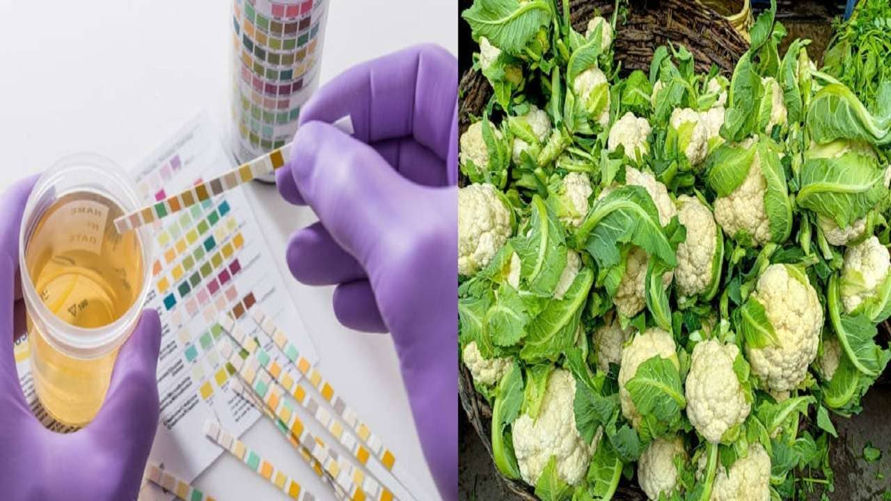 Uric Acid: শীতে এই ৫ খাবারের থেকে দূরত্ব বজায় রাখলেই কমবে জয়েন্টের ব্যথা, নিয়ন্ত্রণে থাকবে ইউরিক অ্যাসিড