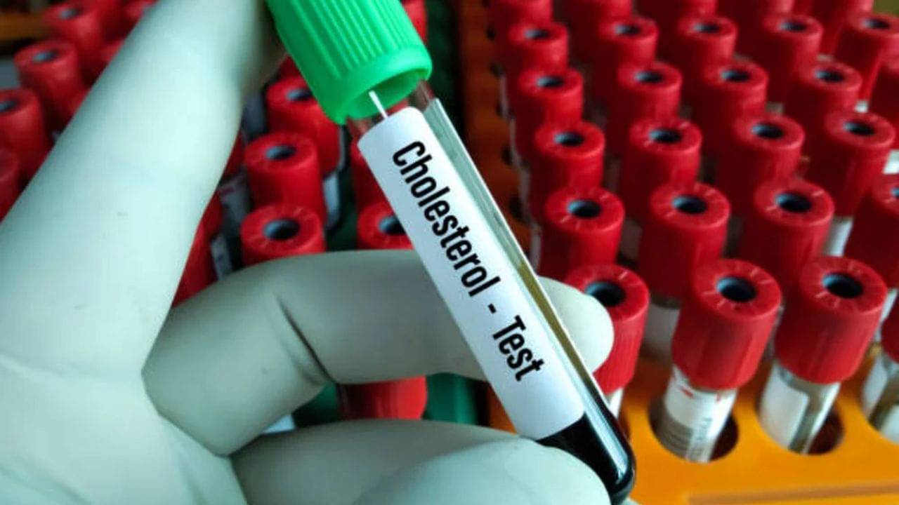 High Cholesterol Control: ওষুধ ছাড়াই কোলেস্টেরল নিয়ন্ত্রণ করুন এই উপায়ে