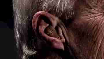 Man Chews Off Ear: বৃদ্ধের কান কামড়ে চিবিয়ে ফেলল যুবক, রক্তে ভাসল প্ল্যাটফর্ম