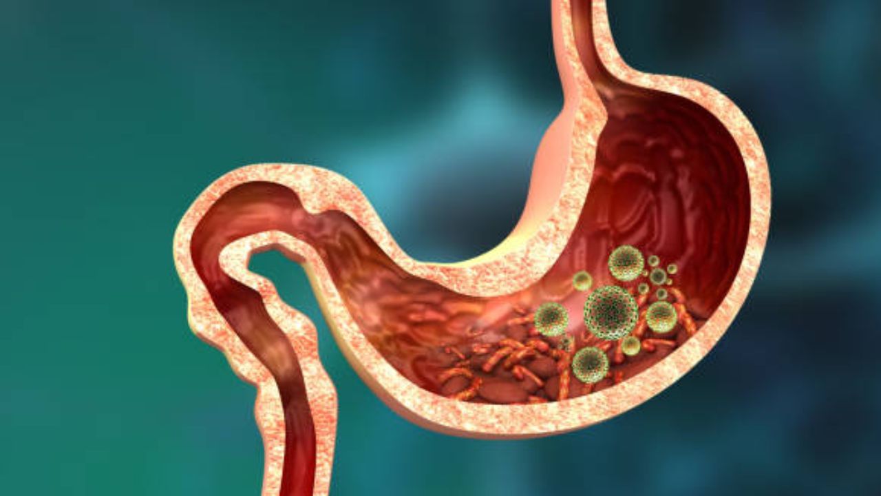 Gastric Problem: When the stomach is irritated? It is not a sign of any ...