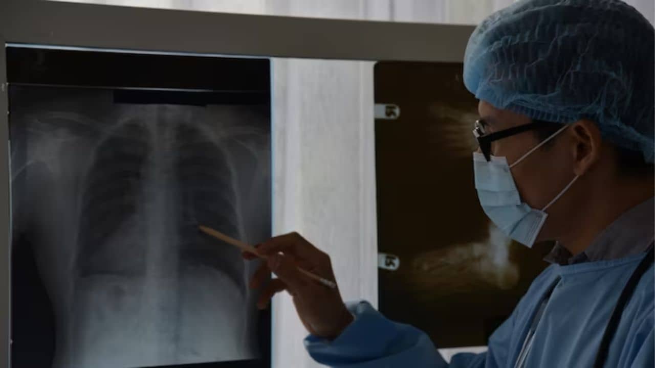 Before Joining Gym Tips: মেদ ঝরাতে দিনরাত জিম করছেন, হার্টের চেকআপ করিয়েছেন কি?