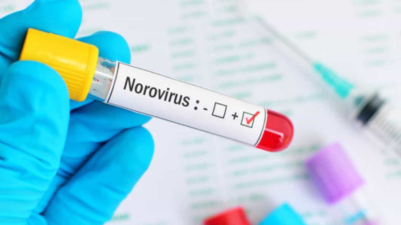 Norovirus: দ্রুত ছড়াচ্ছে নোরাভাইরাস! শিশুকে বাঁচাতে প্রাথমিক লক্ষণ, প্রতিরোধ করবেন কীভাবে, জেনে নিন... Norovirus: দ্রুত ছড়াচ্ছে নোরাভাইরাস! শিশুকে বাঁচাতে প্রাথমিক লক্ষণ, প্রতিরোধ করবেন কীভাবে, জেনে নিন...