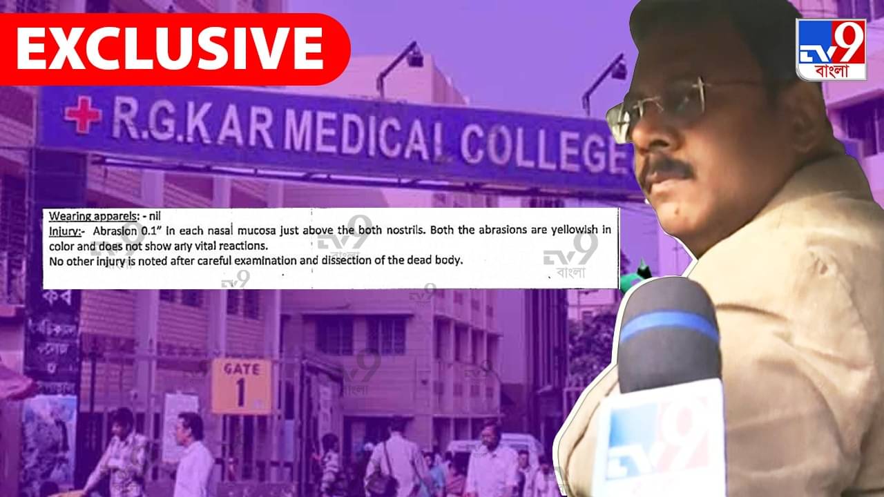 TV9 EXCLUSIVE: প্রতিটি দেহের নাকের উপরে সূক্ষ্ম ক্ষত! ময়নাতদন্তের রিপোর্টে আরও জোরালো কাঁটাছেড়ার তত্ত্ব