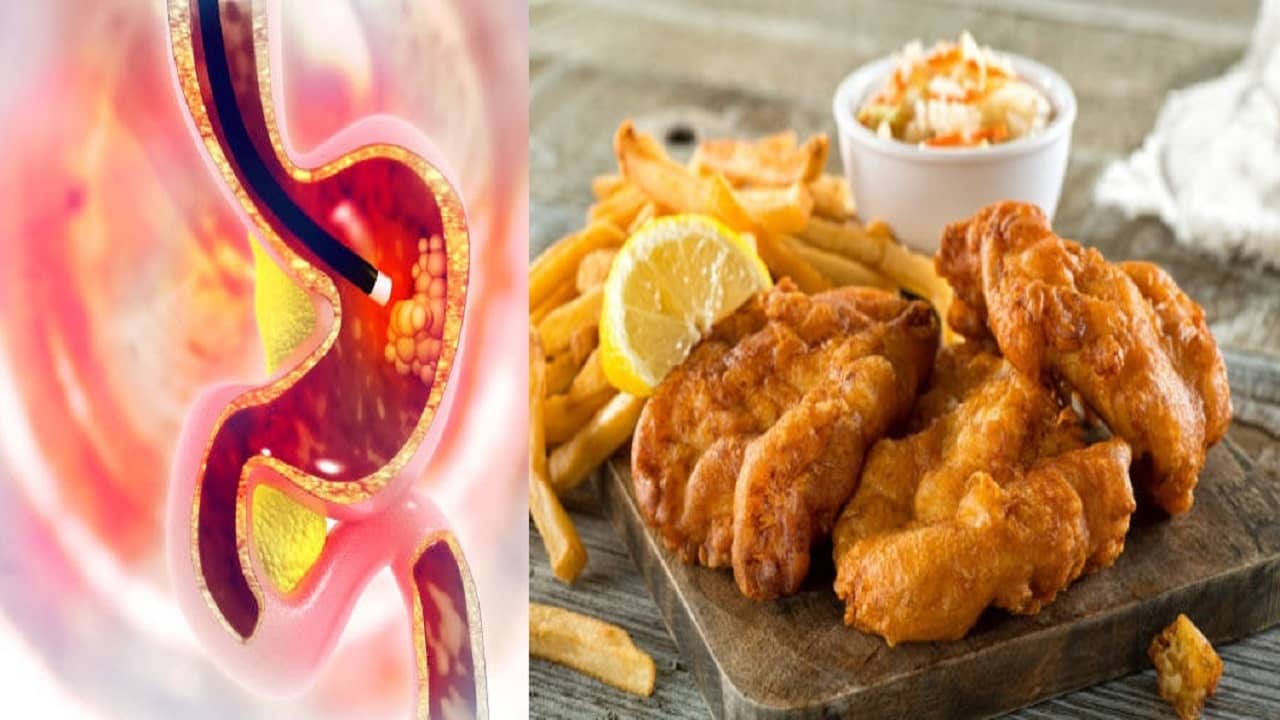Acidity Problem: খেলেই বুক জ্বালা, পেটে গ্যাস, অস্বস্তি? এই ৫ বদঅভ্যাসই আপনার যাবতীয় সমস্যার মূলে
