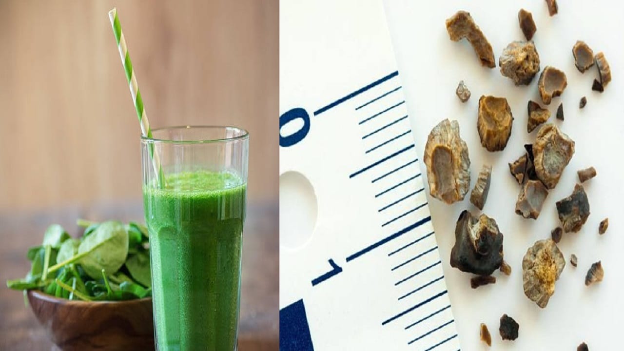 Vegetables causes kidney stone উপকারী হলেও শীতে রোজ খাবেন না এই সবজির