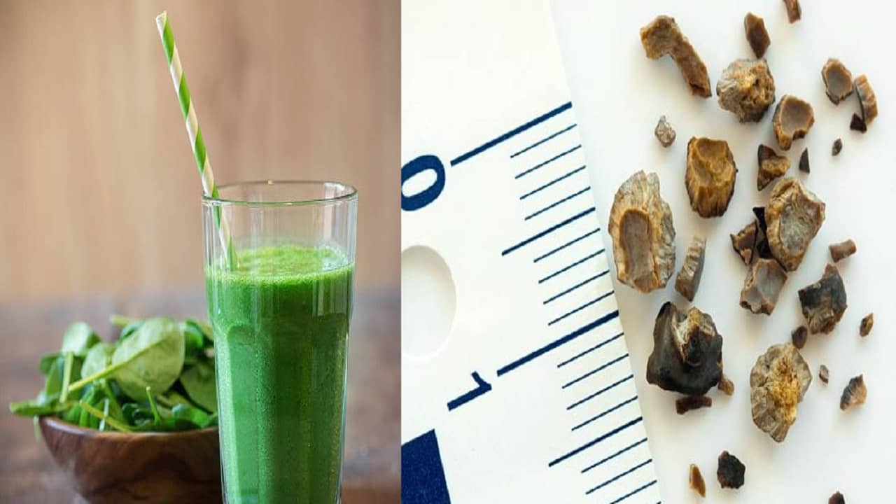 Vegetables causes kidney stone:  উপকারী হলেও শীতে রোজ খাবেন না এই সবজির জুস, কিডনি স্টোনের ঝুঁকি বাড়তে পারে
