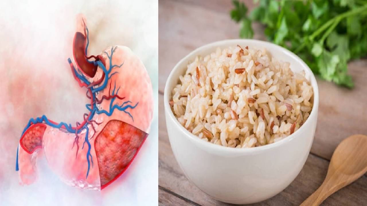 Acidic Food: এইসব অ্যাসিডিক খাবার খেলেই প্রস্রাবে জ্বালাপোড়া ভাব থাকবে, পেট-কিডনিও ভরবে অ্যাসিডে