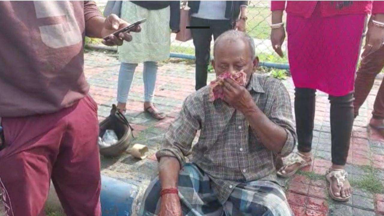 Road Accident: গলগল করে নাক দিয়ে রক্ত বেরোচ্ছে, মুখ চেপে বসে বৃদ্ধ! ফের দুর্ঘটনা সল্টলেকে