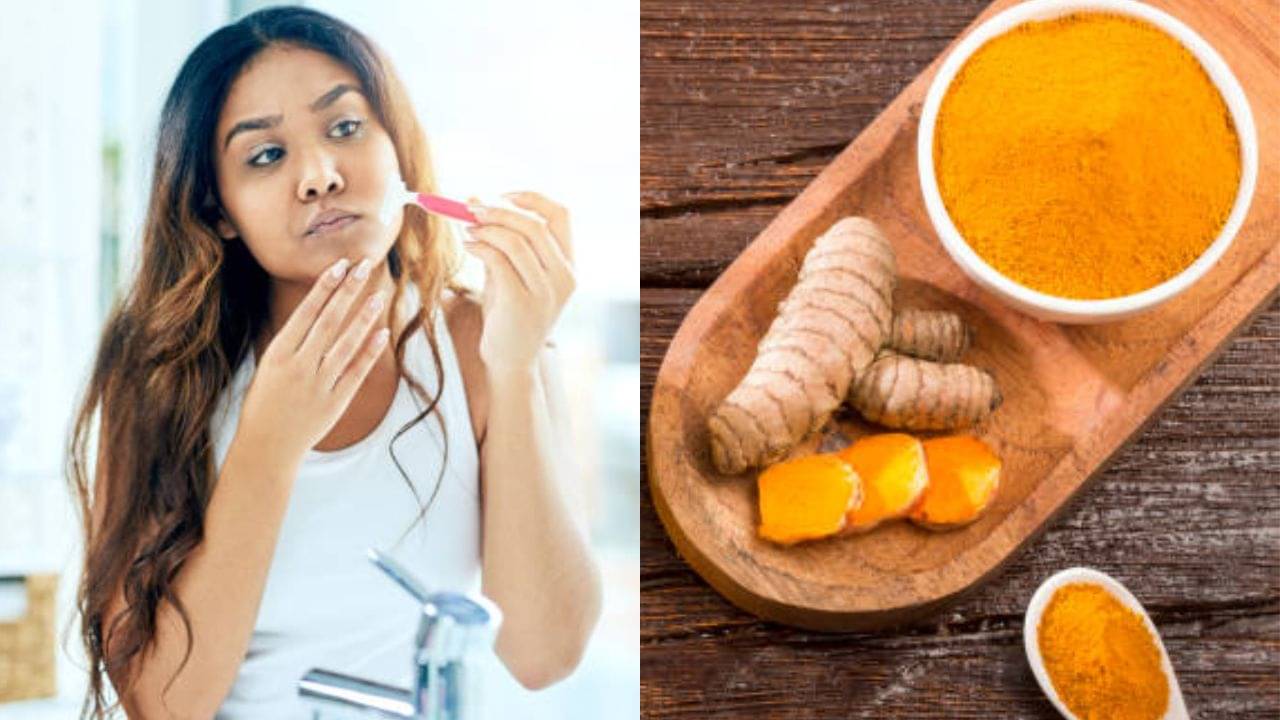 Unwanted Facial Hair Removal: থ্রেডিং, ওয়াক্সিংয়ে র‍্যাশ বেরোয়? অবাঞ্ছিত লোমকে টাটা বলুন এক চিমটে হলুদ দিয়ে