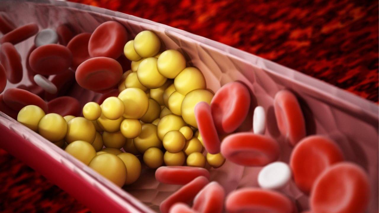 Ayurvedic Remedies: বিনা ওষুধে ৫ দিনের মধ্যেই নিয়ন্ত্রণে আসবে হাই কোলেস্টেরল ও ট্রাইগ্লিসারাইড, পাশে থাকুক ৭ আয়ুর্বেদিক উপায়