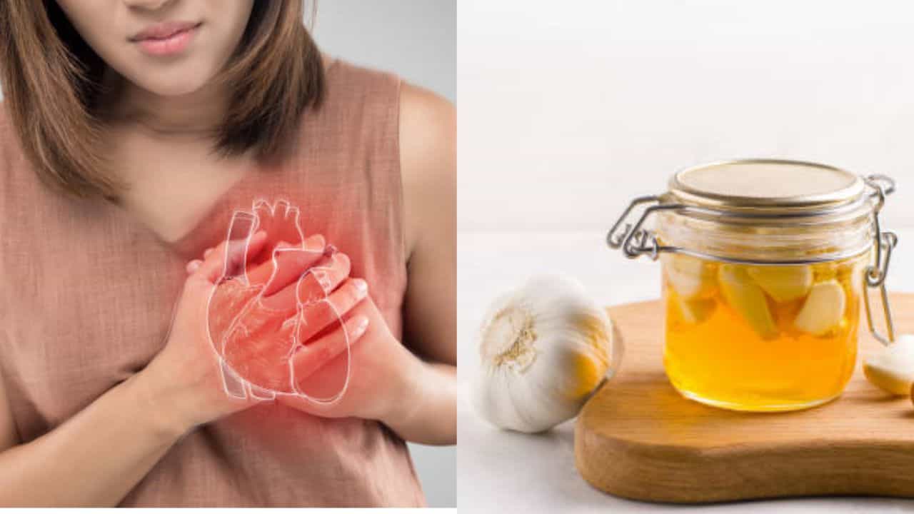 Garlic for health: উচ্চ কোলেস্টেরল ভয় দেখাচ্ছে? এভাবে রসুন খেলে কমতে পারে হৃদরোগের ঝুঁকি Garlic for health: উচ্চ কোলেস্টেরল ভয় দেখাচ্ছে? এভাবে রসুন খেলে কমতে পারে হৃদরোগের ঝুঁকি