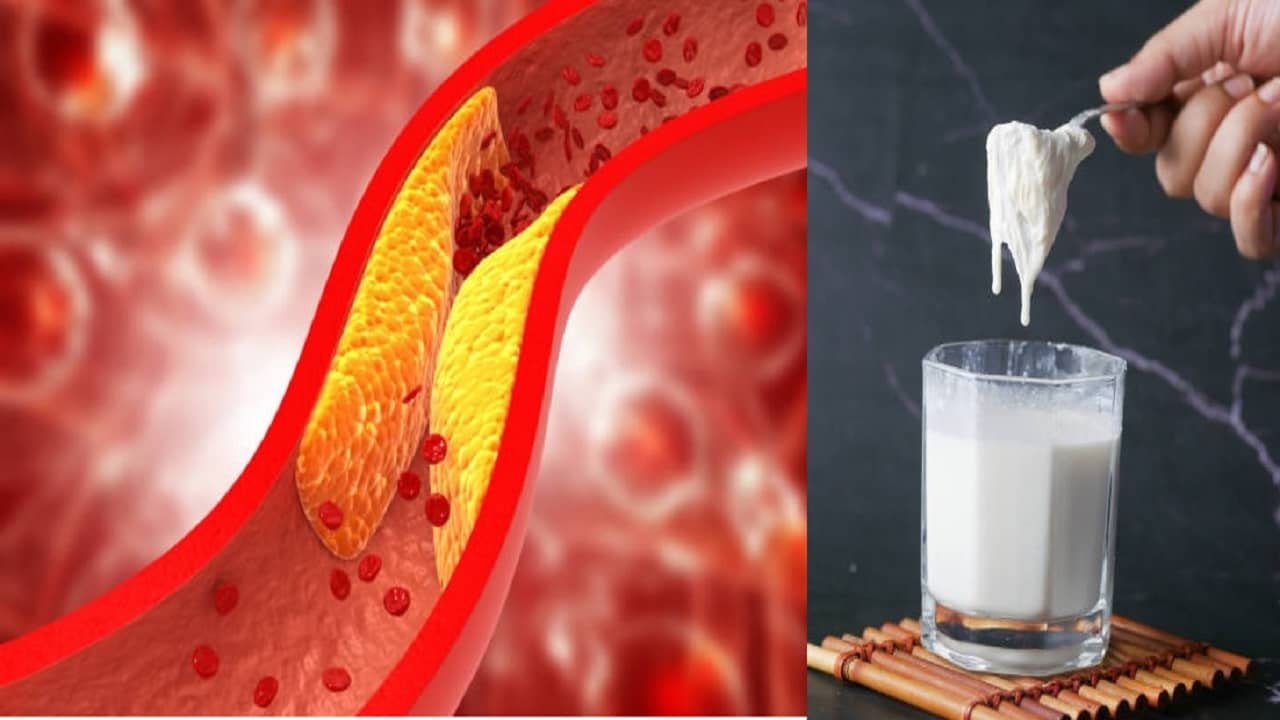 Causes of Cholesterol: এই ৫ তরল পাকস্থলিতে গেলে কোলেস্টেরল বাড়বেই, হতে পারে হার্ট অ্যার্টাকও