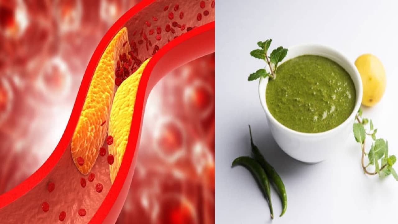 Cholesterol Cutting Chutney: শিরায় জমছে কোলেস্টেরল? রোজ এই চাটনি গরম ভাত দিয়ে খেতে পারলে সব সাফ হবে ২ দিনেই