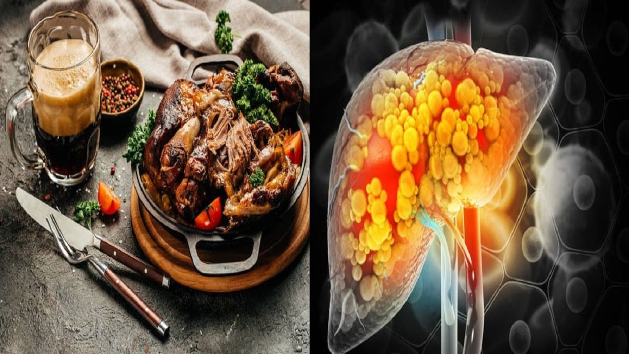 Worst Foods For Liver: লিভারের স্বাস্থ্যের কথা ভেবে এড়িয়ে চলুন এই ৫ খাবার, পরামর্শ পুষ্টিবিদের