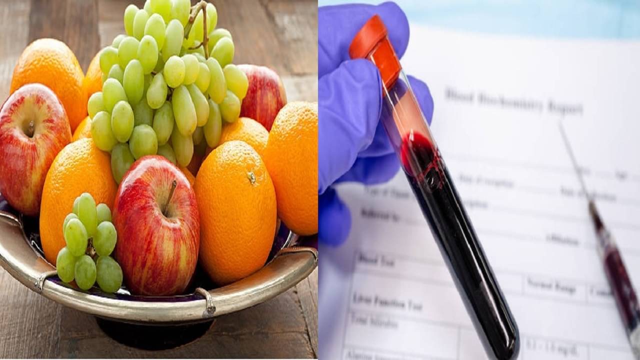 Uric Acid: যত বেশি মিষ্টি ফল ততই বড় সমস্যার ফাঁদ, সুস্থ থাকতে আজ থেকেই এড়িয়ে চলুন