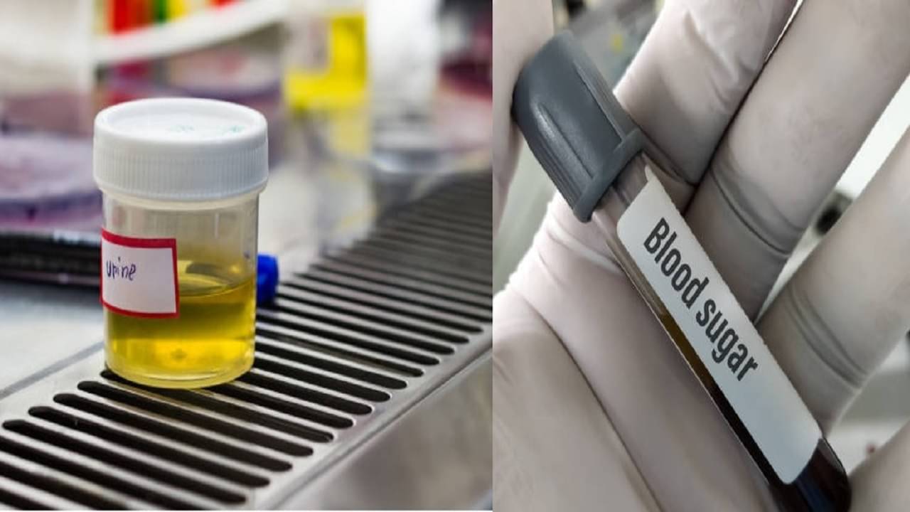 Diabetes Urine Symptoms: প্রস্রাবে এই সব লক্ষণ দেখলেই বোঝা যাবে যে আপনার ডায়াবেটিস হয়েছে