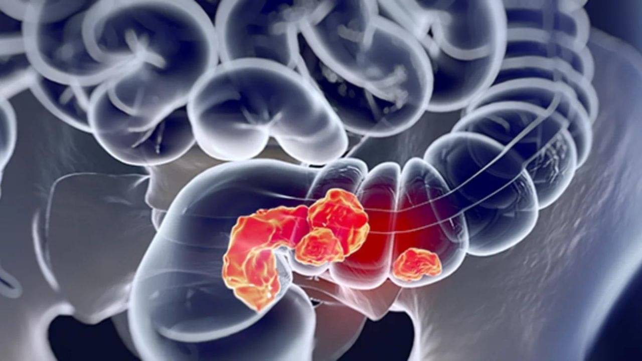 Plastik sumka porno Transvestit bilan porno