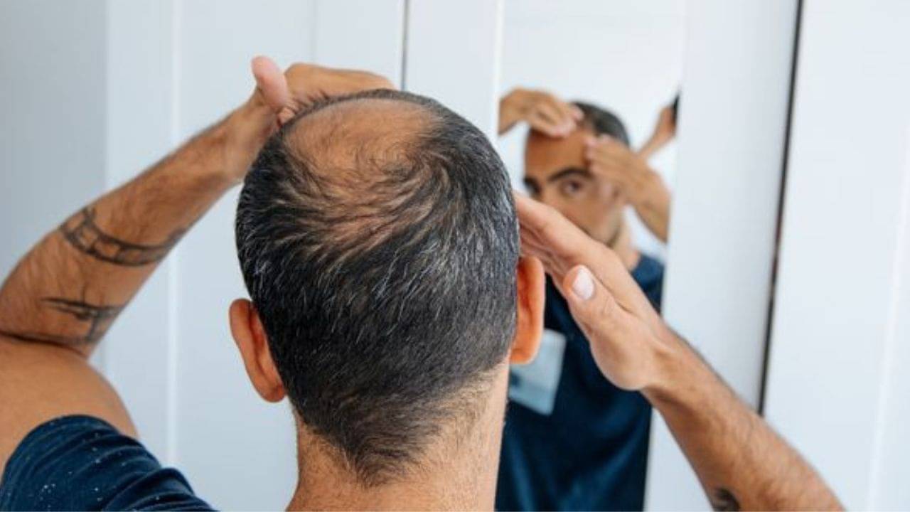 Reduce Balding: টাক নিয়ে আর দুশ্চিন্তা নয়, রোজ এই তেল মাখলেই নতুন চুল গজাবে এক সপ্তাহের মধ্যে