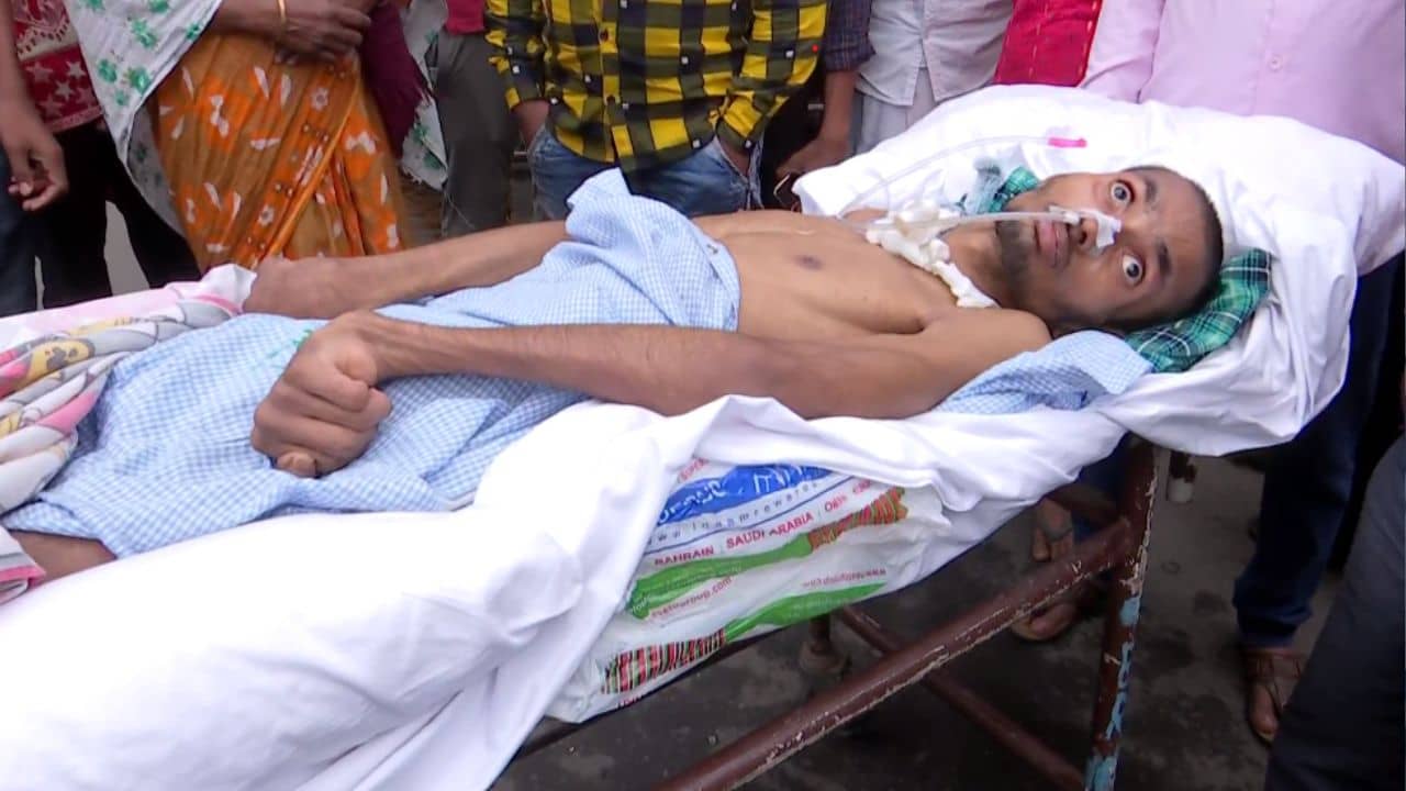 SSKM: জখম ছেলেকে নিয়ে একের পর এক হাসপাতালে পরিবার, দেড়দিন পরও মেলেনি চিকিৎসা