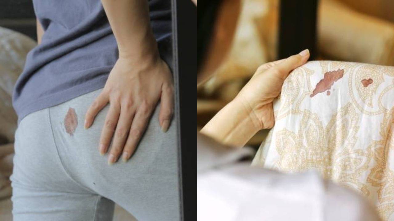 Remove blood stains from clothes: ঋতুস্রাবের দাগ কাচলেও যাচ্ছে না জিনস থেকে, সহজ সমাধানের জন্য জানুন এই উপায়গুলি