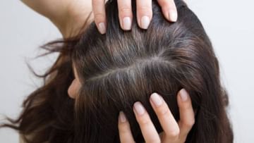 Hair Care: লাগবে না কলপ, এই ঘরোয়া টোটকাতেই পাকা চুল সাদা হবে ৭ দিনেই