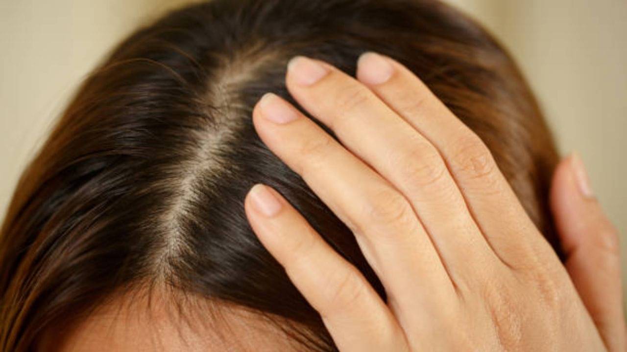 Oily Scalp Treatment: নিমেষে দূর করুন চুলের দুর্গন্ধ, এই ৫ উপায়ে মুক্তি পাবেন স্ক্যাল্পের চিটচিটে ভাব থেকেও