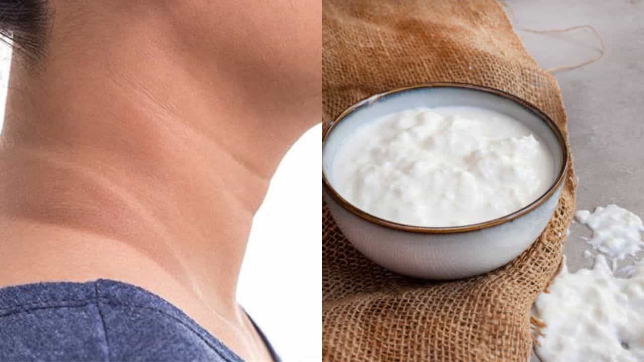 Home Remedies for Dark Neck: ঘাড় জুড়ে বিশ্রী কালো দাগ? ব্র্যান্ডেড ক্রিম ছেড়ে টক দই মাখলেই কেল্লাফতে ৭ দিনে Home Remedies for Dark Neck: ঘাড় জুড়ে বিশ্রী কালো দাগ? ব্র্যান্ডেড ক্রিম ছেড়ে টক দই মাখলেই কেল্লাফতে ৭ দিনে