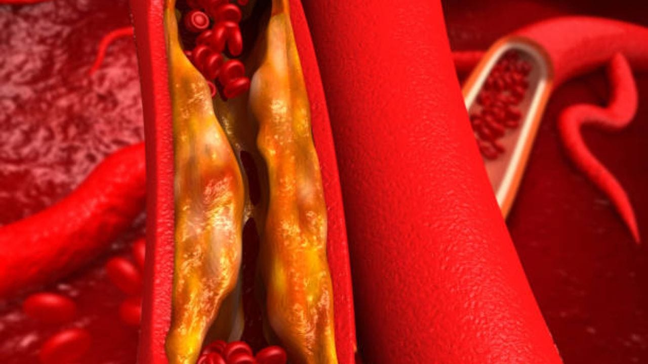 Bad Cholesterol কোলেস্টেরল বাড়লেই ডিম বাদ, কে বলল? জানুন সত্যিটা ঠিক