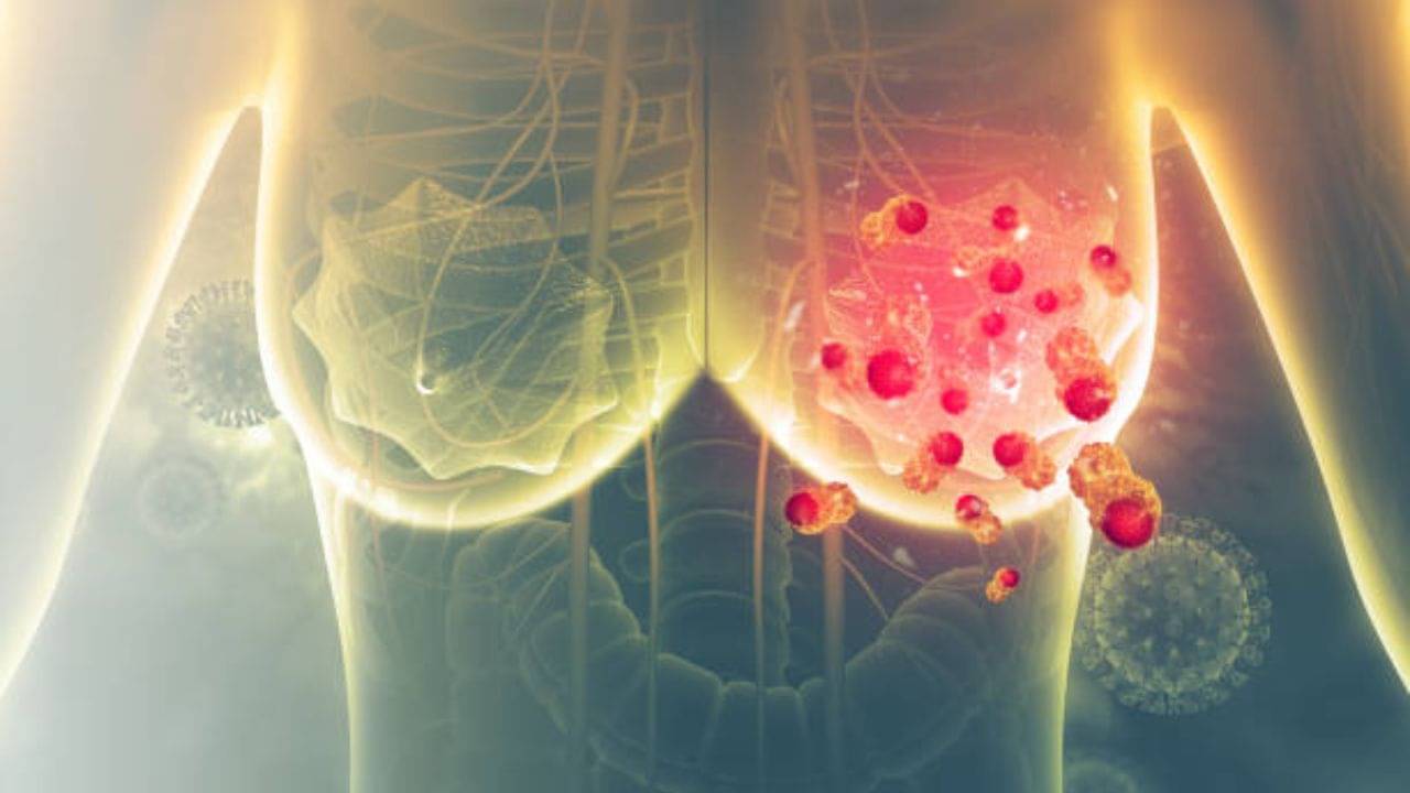 Breast Cancer: অল্প বয়সীদের মধ্যেও বাড়ছে স্তন ক্যানসার, কোন লক্ষণ দেখে বুঝবেন? সতর্কতা হিসেবে যা কিছু মেনে চলবেন...