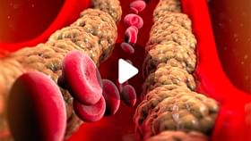 Good Cholesterol Tips: শরীরে ভাল কোলেস্টেরল বাড়াবেন কীভাবে? Good Cholesterol Tips: শরীরে ভাল কোলেস্টেরল বাড়াবেন কীভাবে?