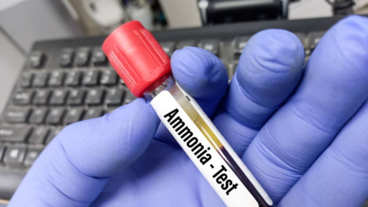 How To Reduce Ammonia অ্যামেনিয়া রক্তে মিশলে সেখান থেকে মস্তিষ্কের