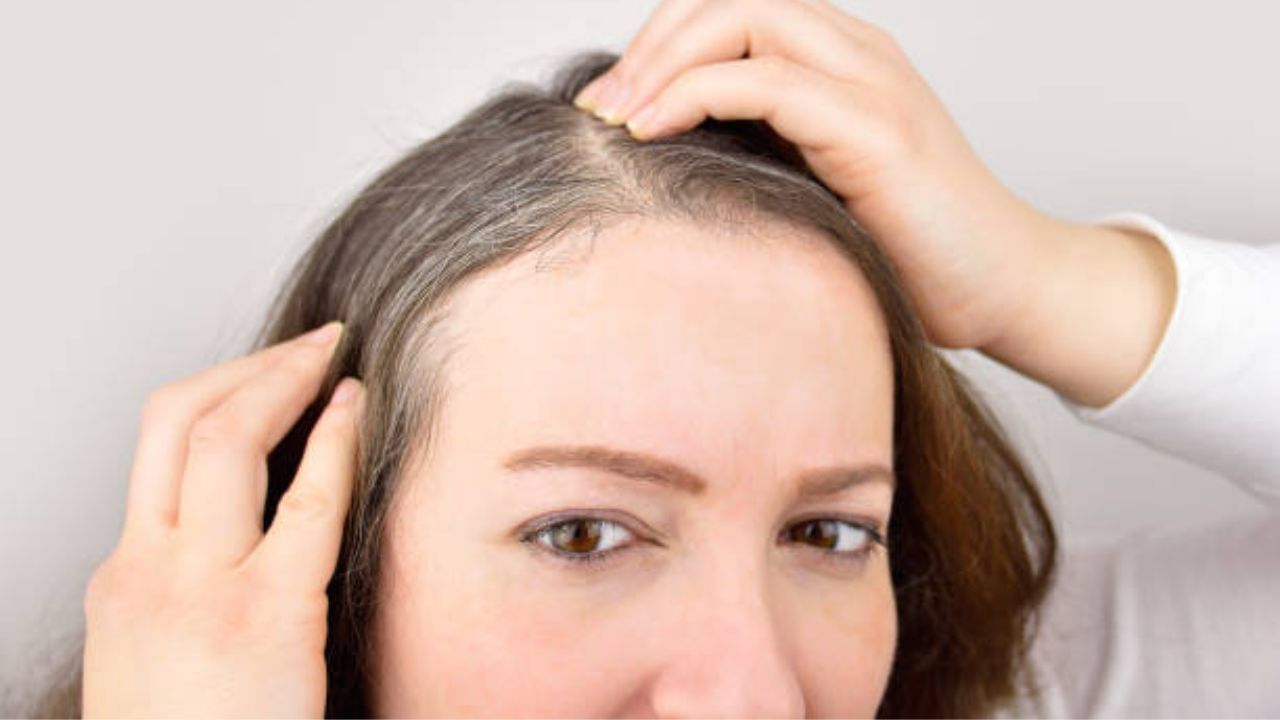 can stress cause gray hair