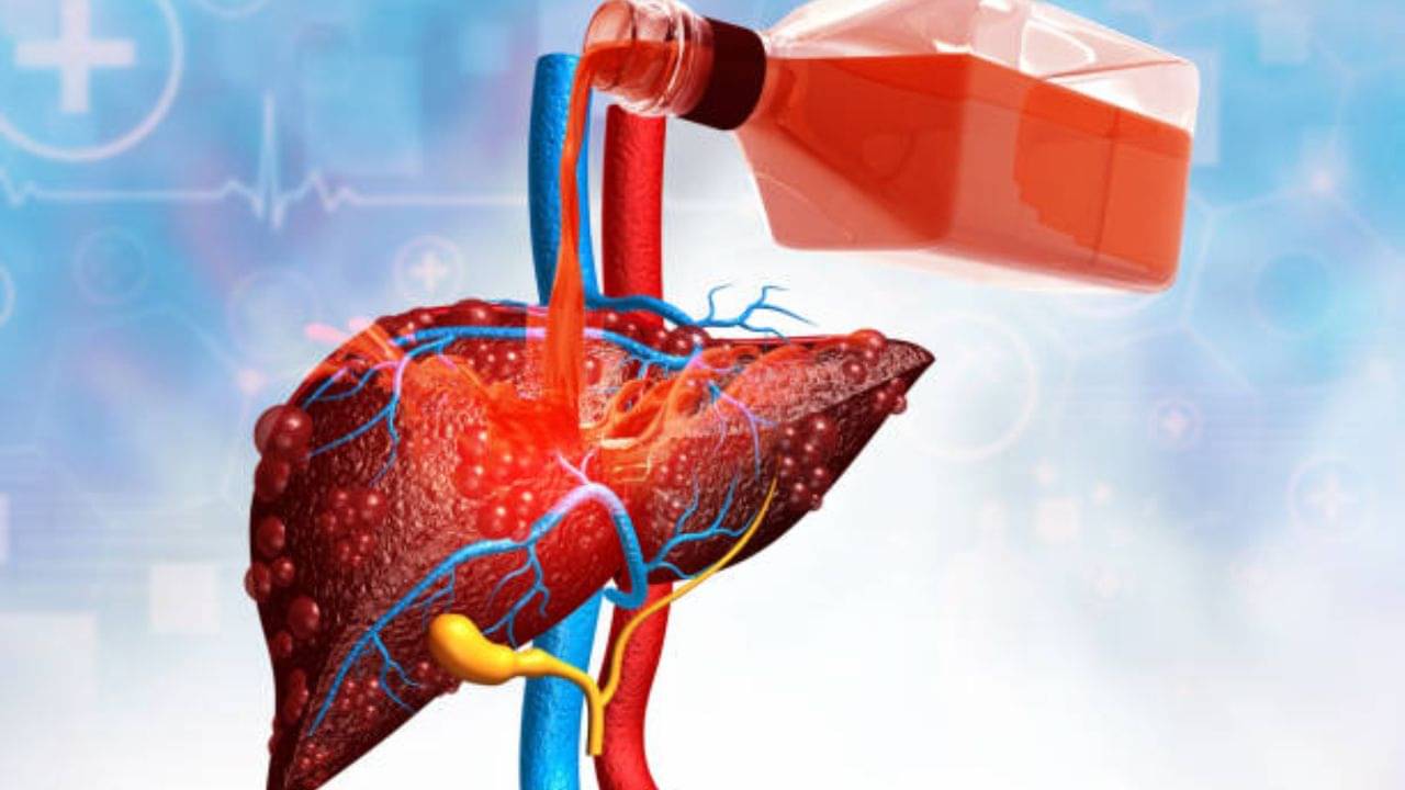 Liver Damage Symptoms: লিভারকে ৮০ শতাংশ ধ্বংস করে দিতে এই সব আমিষ খাবারই দায়ী, বাঁচতে হলে আজ থেকেই বাদ দিন