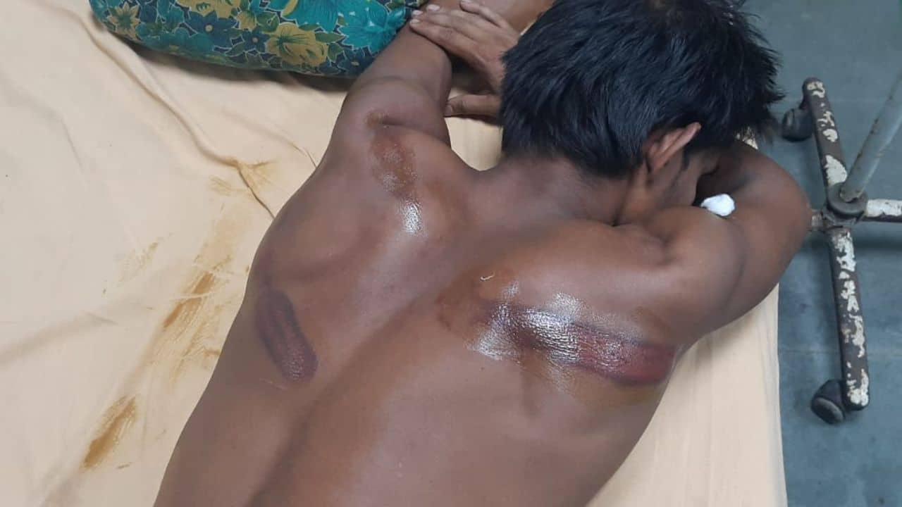 Diamond Harbour: সামাজিক মাধ্যমে দলীয় কর্মসূচির ছবি পোস্ট, ঘৃণ্য আচরণের শিকার বিজেপি কর্মী