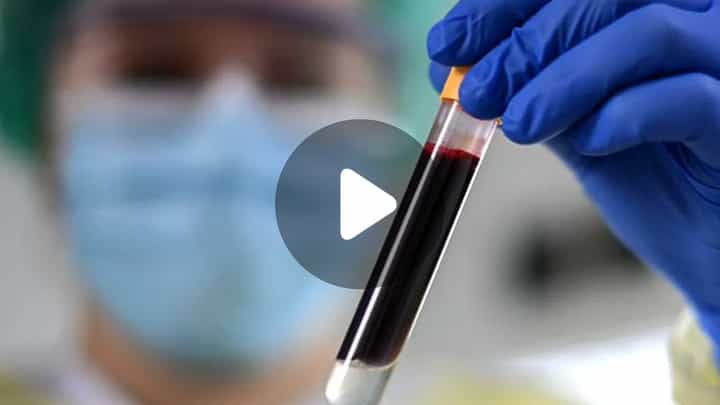 O Negative Blood Group: জেনে নিন O-নেগেটিভ ব্লাড গ্রুপের ডায়েট! O Negative Blood Group: জেনে নিন O-নেগেটিভ ব্লাড গ্রুপের ডায়েট!