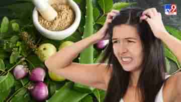 Home Remedies For Dandruff: মাথায় হাত দিলেই ঝরে পড়ছে খুশকি? প্রতিকার লুকিয়ে হাতের কাছেই