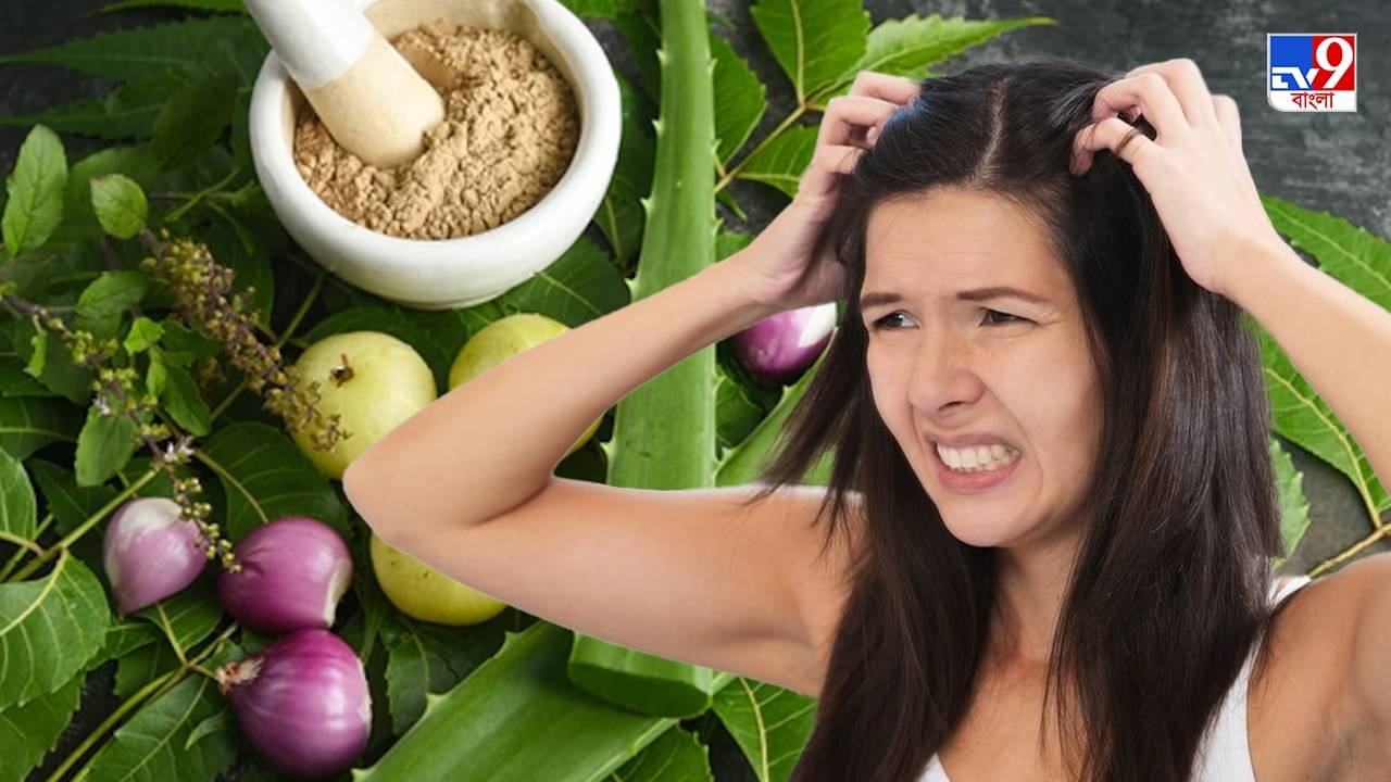 Home Remedies For Dandruff: মাথায় হাত দিলেই ঝরে পড়ছে খুশকি? প্রতিকার লুকিয়ে হাতের কাছেই