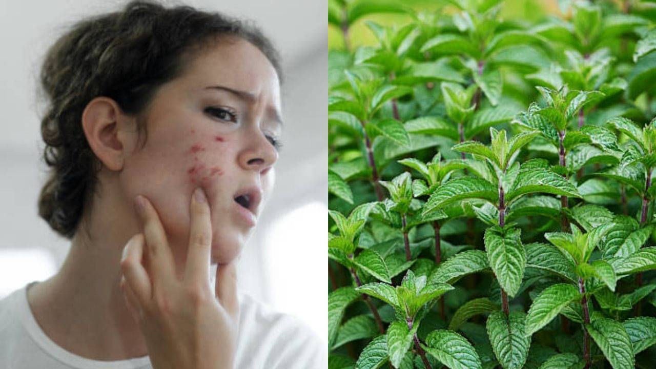 Mint for Acne: তেল-মশলা নয়, এই ভেষজ পাতা বেটে রোজ মাখলে ব্রণ দূর হবে মাত্র ৭ দিনে