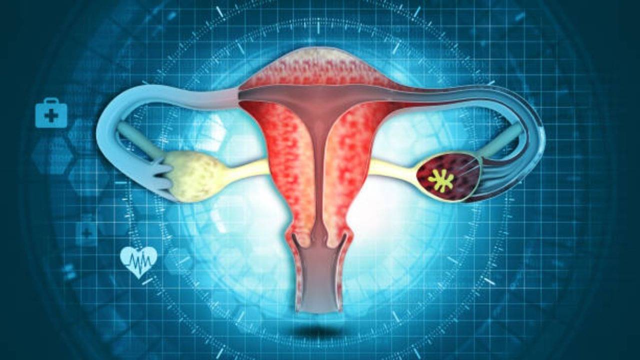 Fibroids: বেশি বয়সের বিয়েতে গর্ভধারণে সমস্যা? ২৫ বছর থেকেই নজর দিন ফাইব্রয়েডসের উপসর্গে