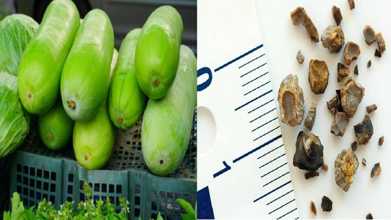 Ash Gourd: সস্তার এই সবজিতেই কিডনি স্টোন ভেঙে টুকরো টুকরো হয়ে যাবে, বেরোবে অতিরিক্ত টক্সিনও