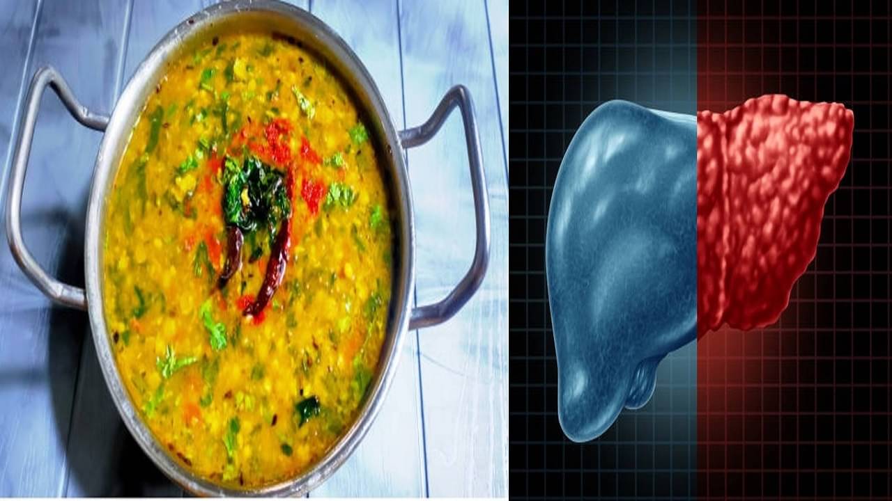 Fatty Liver: এই প্রোটিনই লিভার থেকে টক্সিন টেনে বের করে দেবে, ফ্যাটি লিভারের জন্য সেরা